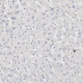 Anti-RTN3 antibody produced in rabbit Prestige Antibodies® Powered by Atlas Antibodies, affinity isolated antibody, buffered aqueous glycerol solution