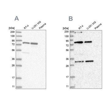 Anti-NOA1 antibody produced in rabbit Prestige Antibodies&#174; Powered by Atlas Antibodies, affinity isolated antibody, buffered aqueous glycerol solution