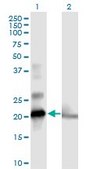 Anti-COMMD1 antibody produced in mouse purified immunoglobulin, buffered aqueous solution