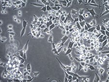 Assay Ready MB49 Mouse Bladder Carcinoma Cell Line