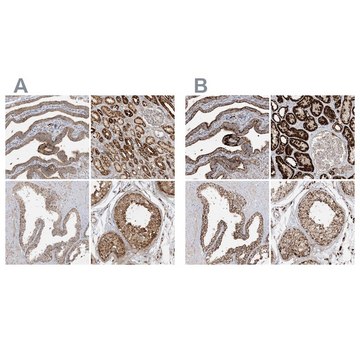 Anti-NDUFAF3 antibody produced in rabbit Prestige Antibodies&#174; Powered by Atlas Antibodies, affinity isolated antibody, buffered aqueous glycerol solution