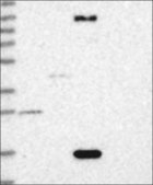 Anti-FAM21B antibody produced in rabbit Prestige Antibodies® Powered by Atlas Antibodies, affinity isolated antibody, buffered aqueous glycerol solution