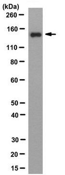 Anti-RNA Helicase A/Dhx9 Antibody, clone 8E3 clone 8E3, from rat