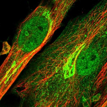 Anti-ENPP2 antibody produced in rabbit Prestige Antibodies&#174; Powered by Atlas Antibodies, affinity isolated antibody