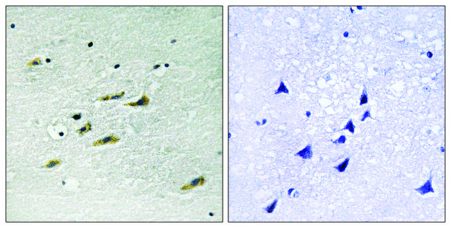 Anti-JAK2 antibody produced in rabbit affinity isolated antibody