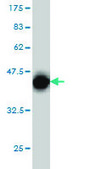 Monoclonal Anti-CRX antibody produced in mouse clone 4G11, purified immunoglobulin, buffered aqueous solution