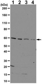 Anti-IRX-3 serum, from rabbit