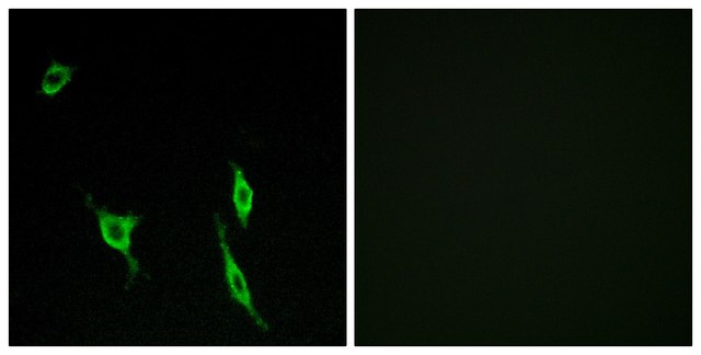 Anti-DCC antibody produced in rabbit affinity isolated antibody