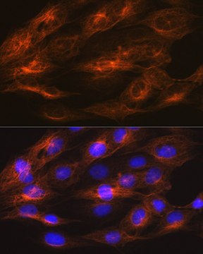 Anti-&#946;II-Tubulin/&#946;2-Tubulin Antibody, clone 1R3R9, Rabbit Monoclonal