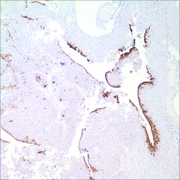 Uroplakin III (SP73) Rabbit Monoclonal Antibody