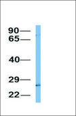 Anti-C4BPB antibody produced in rabbit affinity isolated antibody