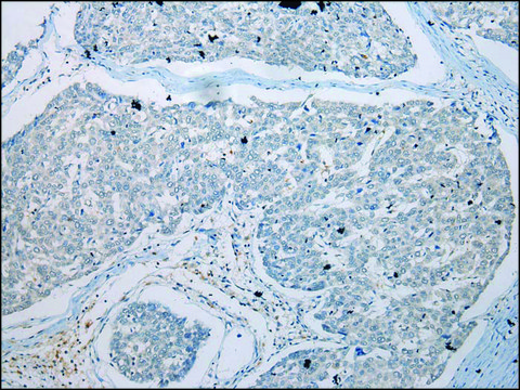 Anti-GDF10 affinity isolated antibody