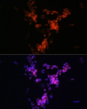 Anti-CHAT antibody produced in rabbit