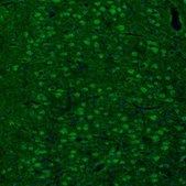 Anti-ARHGAP1 antibody produced in rabbit Prestige Antibodies® Powered by Atlas Antibodies, affinity isolated antibody, buffered aqueous glycerol solution