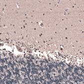 Monoclonal Anti-GLI1 antibody produced in mouse Prestige Antibodies® Powered by Atlas Antibodies, clone CL12192, purified immunoglobulin, buffered aqueous glycerol solution