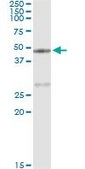 Monoclonal Anti-CPA1 antibody produced in mouse clone 3F11, purified immunoglobulin, buffered aqueous solution