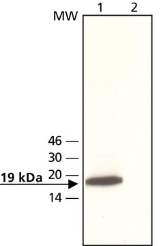 Anti-OMP 兔抗 ~2&#160;mg/mL, affinity isolated antibody, buffered aqueous solution