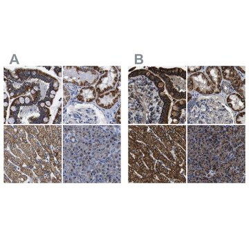 Anti-ETFA antibody produced in rabbit Prestige Antibodies&#174; Powered by Atlas Antibodies, affinity isolated antibody, buffered aqueous glycerol solution