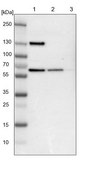 Anti-UPF3B antibody produced in rabbit Ab1, Prestige Antibodies® Powered by Atlas Antibodies, affinity isolated antibody, buffered aqueous glycerol solution