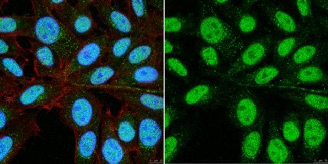 Anti-PHD finger protein 14 (PHF14) from rabbit, purified by affinity chromatography