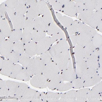 Anti-OGFOD1 antibody produced in rabbit Prestige Antibodies&#174; Powered by Atlas Antibodies, affinity isolated antibody, buffered aqueous glycerol solution