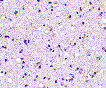 Anti-TMP21 (ab2) antibody produced in rabbit affinity isolated antibody, buffered aqueous solution