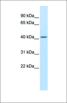 Anti-EPSTI1 antibody produced in rabbit affinity isolated antibody