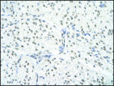 Anti-SNRPA antibody produced in rabbit affinity isolated antibody