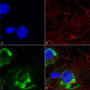 Monoclonal Anti-Lrrk2/Dardarin - Biotin antibody produced in mouse clone S231B-34, purified immunoglobulin