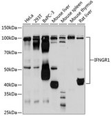 Anti-IFNGR1 antibody produced in rabbit