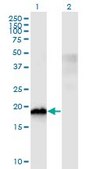 Monoclonal Anti-CIRBP, (N-terminal) antibody produced in mouse clone 1C9, purified immunoglobulin, buffered aqueous solution