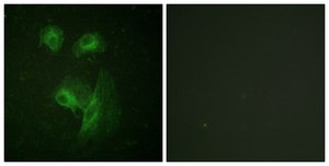 Anti-p70 S6 Kinase antibody produced in rabbit affinity isolated antibody