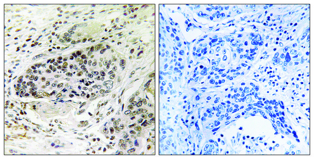 Anti-APBA2 antibody produced in rabbit affinity isolated antibody