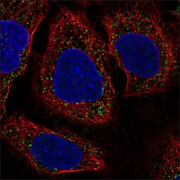 Anti-IGFBP5 antibody produced in rabbit Prestige Antibodies&#174; Powered by Atlas Antibodies, affinity isolated antibody