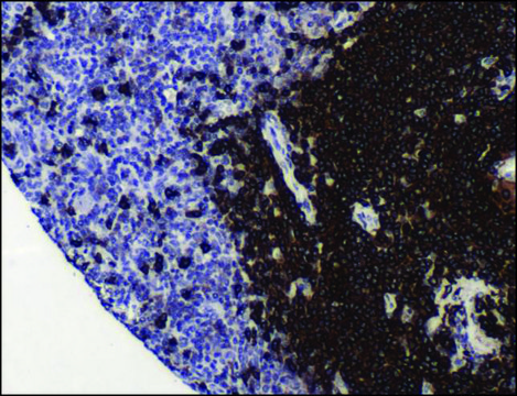 Anti-CD20 antibody, Rabbit monoclonal clone SP32, recombinant, expressed in proprietary host, affinity isolated antibody