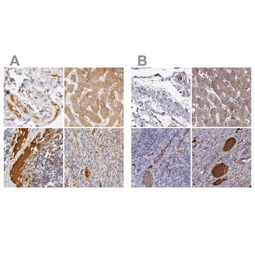 Anti-TF antibody produced in rabbit Ab1, Prestige Antibodies&#174; Powered by Atlas Antibodies, affinity isolated antibody, buffered aqueous glycerol solution