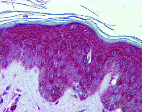 抗 PRDX6 (AB1) 兔抗 affinity isolated antibody