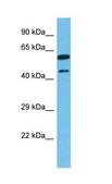 Anti-NR2F1 (ab1) antibody produced in rabbit affinity isolated antibody