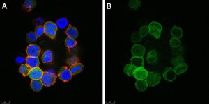 Anti-Anosmin Antibody, clone 2C17 ZooMAb® Rabbit Monoclonal recombinant, expressed in HEK 293 cells