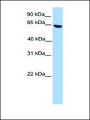Anti-ACADVL antibody produced in rabbit affinity isolated antibody