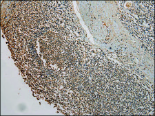 Anti-UBE2B affinity isolated antibody