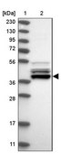 Anti-UROD antibody produced in rabbit Prestige Antibodies® Powered by Atlas Antibodies, affinity isolated antibody, buffered aqueous glycerol solution