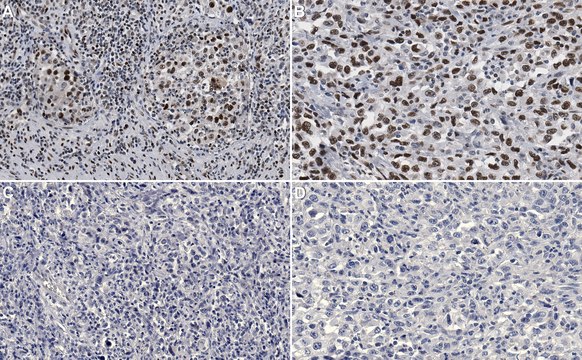 Anti-phospho-CREB (Ser133) Antibody, clone 10E9 clone 10E9, Upstate&#174;, from mouse