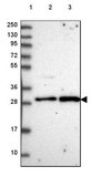 Anti-CENPQ antibody produced in rabbit Prestige Antibodies® Powered by Atlas Antibodies, affinity isolated antibody, buffered aqueous glycerol solution