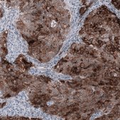 Anti-WFDC2 antibody produced in mouse Prestige Antibodies® Powered by Atlas Antibodies, clone CL12917, purified by using Protein A, buffered aqueous glycerol solution