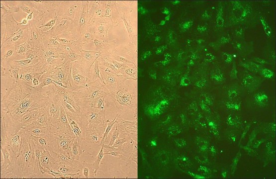 Human Lung Fibroblasts: HLF, fetal