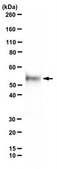 Anti-Legumain/Asparaginyl endopeptidase antibody Clone 6E3