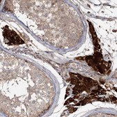 Anti-OBSL1 antibody produced in rabbit Prestige Antibodies® Powered by Atlas Antibodies, affinity isolated antibody, buffered aqueous glycerol solution