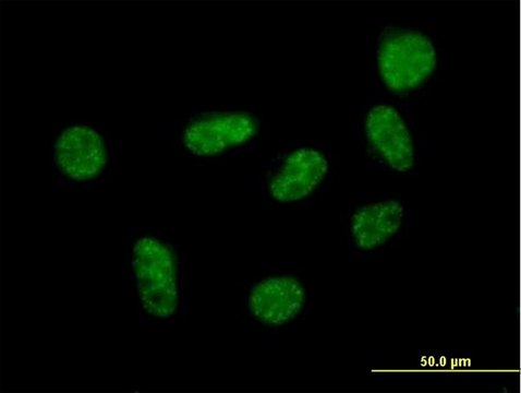 Anti-SART1 antibody produced in mouse purified immunoglobulin, buffered aqueous solution