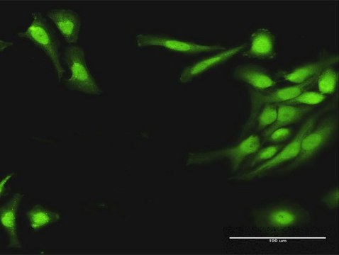 Anti-HRASLS3 antibody produced in rabbit purified immunoglobulin, buffered aqueous solution